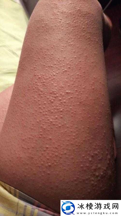 女生打扑克时腿迈开又疼又痒的经历