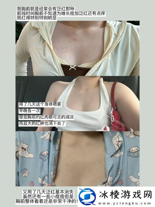 独特体验一面膜胸口与一面膜下部位-友：