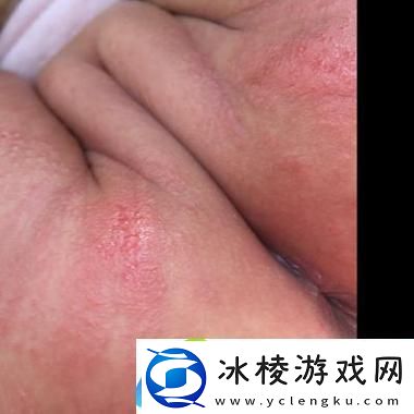 宝宝下面都湿透了还嘴硬疼咋回事网友：家长应该如何应对